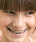 Orthodontiste enfants Lyon